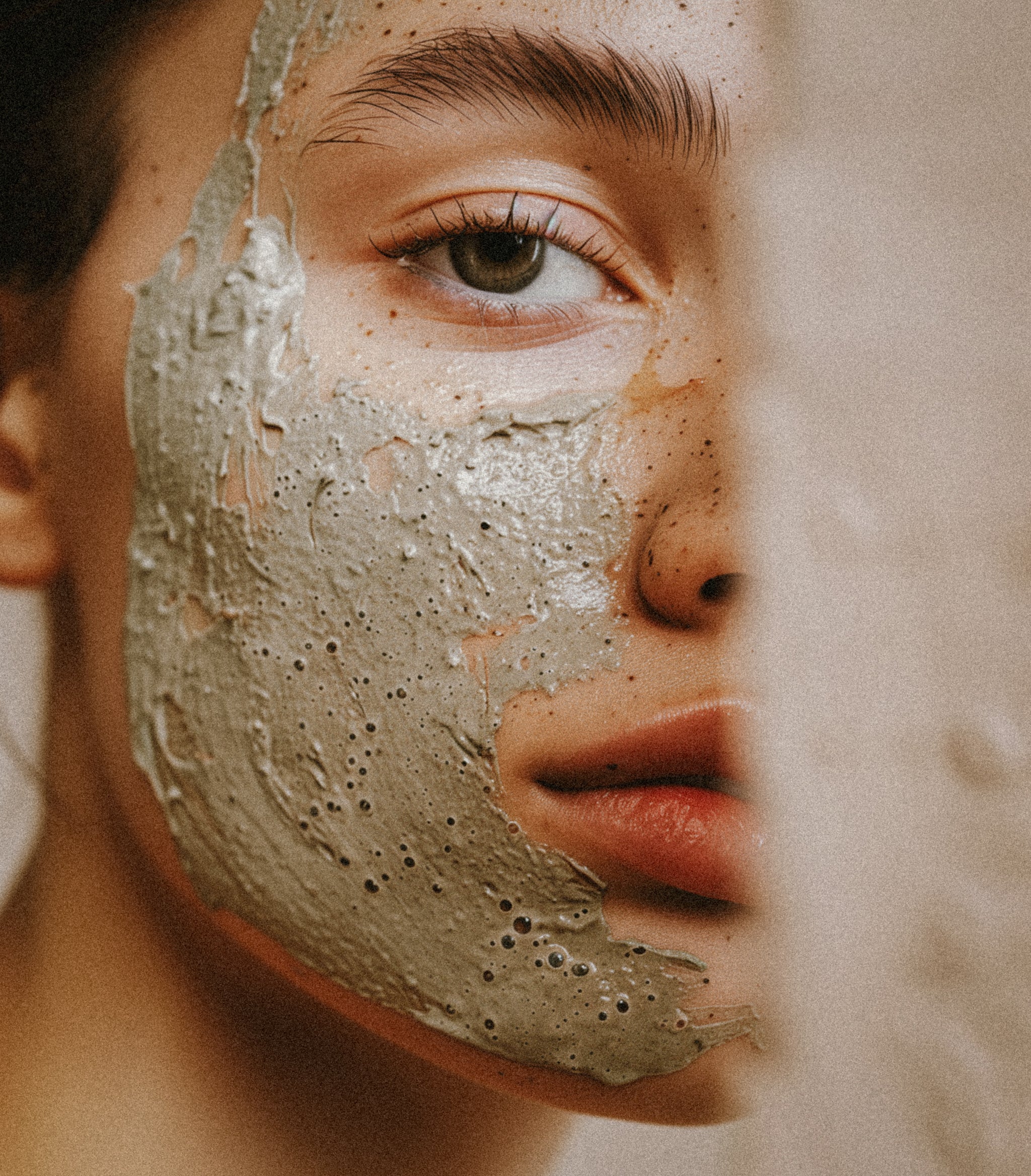 Ayurvedic Remedies for Acne You Should Know